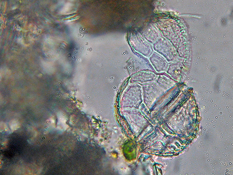 Dinoflagellato ?